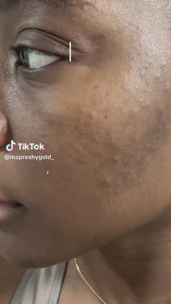 The Ordinary Glycolic Acid 7% Exfoliating Toner